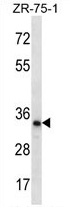 TLCD2 Antibody (C-term) western blot analysis in ZR-75-1 cell line lysates (35 ug/lane). This demonstrates the TLCD2 antibody detected the TLCD2 protein (arrow).