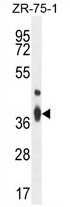 TMBIM4 Antibody (N-term) western blot analysis in ZR-75-1 cell line lysates (35 ug/lane). This demonstrates the TMBIM4 antibody detected the TMBIM4 protein (arrow).