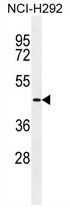 TMPRSS11E2 Antibody (Center) western blot analysis in NCI-H292 cell line lysates (35 ug/lane). This demonstrates the TMPRSS11E2 antibody detected the TMPRSS11E2 protein (arrow).