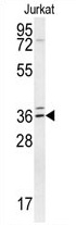 TPGS2 Antibody (Center) western blot analysis in Jurkat cell line lysates (35 ug/lane). This demonstrates the TPGS2 antibody detected the TPGS2 protein (arrow).
