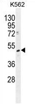 Sample (30ug of whole cell lysate). A: Hela. 12% SDS PAGE. NME5 antibody. TA308136 diluted at 1:1000.