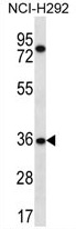 TSGA13 Antibody (C-term) western blot analysis in NCI-H292 cell line lysates (35 ug/lane). This demonstrates the TSGA13 antibody detected the TSGA13 protein (arrow).