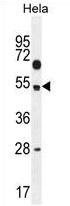 Edc3 antibody [N2C2], Internal detects EDC3 protein by Western blot analysis. A. 30ug NIH-3T3 whole cell lysate/extract. B. 30ug C2C12 whole cell lysate/extract. 7.5 % SDS-PAGE. Edc3 antibody [N2C2], Internal (TA308155) dilution: 1:1000