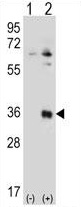 Sample (50ug of whole cell lysate). A: mouse liver. 7.5% SDS PAGE. TA308158 diluted at 1:1000.