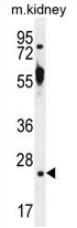 TTC9B Antibody (C-term) western blot analysis in mouse kidney tissue lysates (35 ug/lane). This demonstrates the TTC9B antibody detected the TTC9B protein (arrow).