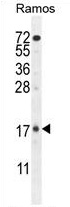 TTC9C Antibody (N-term) western blot analysis in Ramos cell line lysates (35 ug/lane). This demonstrates the TTC9C antibody detected the TTC9C protein (arrow).