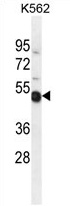 TXNDC6 Antibody (Center) western blot analysis in K562 cell line lysates (35 ug/lane). This demonstrates the TXNDC6 antibody detected the TXNDC6 protein (arrow). TXNDC6 Antibody (Center) western blot analysis in K562 cell line lysates (35 ug/lane). This demonstrates the TXNDC6 antibody detected the TXNDC6 protein (arrow).