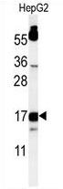 Western blot analysis of TYROBP Antibody (C-term) in HepG2 cell line lysates (35 ug/lane). TYROBP (arrow) was detected using the purified Pab.