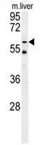 Sample (30ug of whole cell lysate). A: A431. 7.5% SDS PAGE. TA308183 diluted at 1:1000