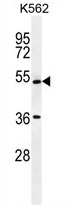 Sample (30ug of whole cell lysate). A: A431. 12% SDS PAGE. TA308185 diluted at 1:1000