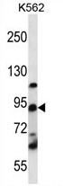 Sample (30ug of whole cell lysate). A:MOLT4. B:Raji. 15% SDS PAGE. TA308198 diluted at 1:1500