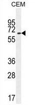 UNCX Antibody (C-term) western blot analysis in CEM cell line lysates (35 ug/lane). This demonstrates the UNCX antibody detected the UNCX protein (arrow).