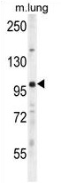 UNK Antibody (N-term) western blot analysis in mouse lung tissue lysates (35 ug/lane). This demonstrates the UNK antibody detected the UNK protein (arrow).