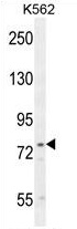 UROC1 Antibody (Center) western blot analysis in K562 cell line lysates (35 ug/lane). This demonstrates the UROC1 antibody detected the UROC1 protein (arrow).