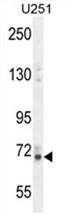 FBXL3 antibody detects FBXL3 protein by Western blot analysis. A. 30ug C2C12 whole cell lysate/extract. 10 % SDS-PAGE. FBXL3 antibody (TA308248) dilution: 1:500