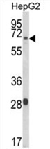 Western blot analysis of WAC Antibody (Center) in HepG2 cell line lysates (35 ug/lane). WAC (arrow) was detected using the purified Pab.