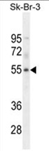 WDR21B Antibody (C-term) western blot analysis in SK-BR-3 cell line lysates (35 ug/lane). This demonstrates the WDR21B antibody detected the WDR21B protein (arrow).