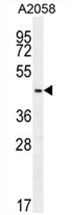 WDR21C Antibody (N-term) western blot analysis in A2058 cell line lysates (35 ug/lane). This demonstrates the WDR21C antibody detected the WDR21C protein (arrow).