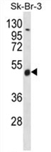 WDR34 Antibody (Center) western blot analysis in SK-BR-3 cell line lysates (35 ug/lane). This demonstrates the WDR34 antibody detected the WDR34 protein (arrow).