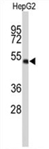Sample (30ug of whole cell lysate). A: Hep G2. 10% SDS PAGE. SCAP2 antibody. TA308273 diluted at 1:1000.