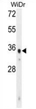 Sample (30ug of whole cell lysate). A: H1299. B: Hela. C: Molt-4. 7.5% SDS PAGE. TA308280 diluted at 1:5000.
