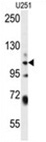 WWC3 Antibody (C-term) western blot analysis in U251 cell line lysates (35 ug/lane). This demonstrates the WWC3 antibody detected the WWC3 protein (arrow).