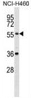 XKRX Antibody (C-term) western blot analysis in NCI-H460 cell line lysates (35 ug/lane). This demonstrates the XKRX antibody detected the XKRX protein (arrow).