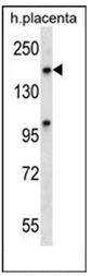 Western blot analysis of XPO5 Antibody (C-term) in human placenta tissue lysates (35 ug/lane). This demonstrates the XPO5 antibody detected the XPO5 protein (arrow).