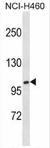 XYLT1 Antibody (N-term) western blot analysis in NCI-H460 cell line lysates (35 ug/lane). This demonstrates the XYLT1 antibody detected the XYLT1 protein (arrow).