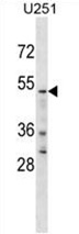 YTHD2 Antibody (C-term) western blot analysis in U251 cell line lysates (35 ug/lane). This demonstrates the YTHD2 antibody detected the YTHD2 protein (arrow).