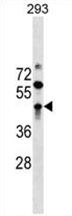 ZBTB32 Antibody (N-term) western blot analysis in 293 cell line lysates (35 ug/lane). This demonstrates the ZBTB32 antibody detected the ZBTB32 protein (arrow).