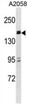 ZBTB38 Antibody (N-term) western blot analysis in A2058 cell line lysates (35 ug/lane). This demonstrates the ZBTB38 antibody detected the ZBTB38 protein (arrow).
