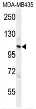 ZC3H3 Antibody (C-term) western blot analysis in MDA-MB435 cell line lysates (35 ug/lane). This demonstrates the ZC3H3 antibody detected the ZC3H3 protein (arrow).