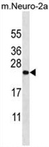 ZCRB1 Antibody (C-term) western blot analysis in mouse Neuro-2a cell line lysates (35 ug/lane). This demonstrates the ZCRB1 antibody detected the ZCRB1 protein (arrow).