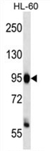 ZHX3 Antibody (C-term) western blot analysis in HL-60 cell line lysates (35 ug/lane). This demonstrates the ZHX3 antibody detected the ZHX3 protein (arrow).