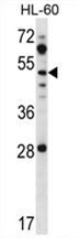 Sample (30ug of whole cell lysate). A: A431. B: Hela. 10% SDS PAGE. TA308356 diluted at 1:1000.