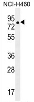 ZNF28 Antibody (N-term) western blot analysis in NCI-H460 cell line lysates (35 ug/lane). This demonstrates the ZNF28 antibody detected the ZNF28 protein (arrow).