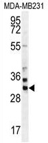 ZNF321 Antibody (N-term) western blot analysis in MDA-MB231 cell line lysates (35 ug/lane). This demonstrates the ZNF321 antibody detected the ZNF321 protein (arrow).