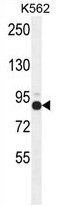 ZNF366 Antibody (C-term) western blot analysis in K562 cell line lysates (35 ug/lane). This demonstrates the ZNF366 antibody detected the ZNF366 protein (arrow).