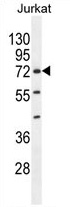 ZNF648 Antibody (N-term) western blot analysis in Jurkat cell line lysates (35 ug/lane). This demonstrates the ZNF648 antibody detected the ZNF648 protein (arrow).