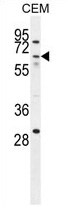 ZNF674 Antibody (N-term) western blot analysis in CEM cell line lysates (35 ug/lane). This demonstrates the ZNF674 antibody detected the ZNF674 protein (arrow).