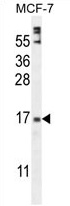 ZNF720 Antibody (Center) western blot analysis in MCF-7 cell line lysates (35 ug/lane). This demonstrates the ZNF720 antibody detected the ZNF720 protein (arrow).