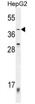 ZNF763 Antibody (C-term) western blot analysis in HepG2 cell line lysates (35 ug/lane). This demonstrates the ZNF763 antibody detected the ZNF763 protein (arrow).