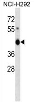 ZNF843 Antibody (Center) western blot analysis in NCI-H292 cell line lysates (35 ug/lane). This demonstrates the ZNF843 antibody detected the ZNF843 protein (arrow).