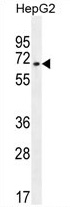 ZNF860 Antibody (C-term) western blot analysis in HepG2 cell line lysates (35 ug/lane). This demonstrates the ZNF860 antibody detected the ZNF860 protein (arrow).