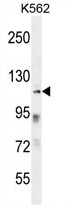 ZNF99 Antibody (N-term) western blot analysis in K562 cell line lysates (35 ug/lane). This demonstrates the ZNF99 antibody detected the ZNF99 protein (arrow).