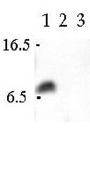 Western Blot analsyis using Cellubrevin antibody in Human CaCo-2 cell extract (Lane 1), Canine MDCK cell extract (Lane 2) and Rat PC12 cell extract. Ref: Galli et al., Mol. Biol. Cell 1998