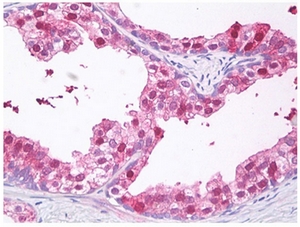 Prostate stained with VPS24 antibody Cat.-No AP54843PU-N in Immunohistochemistry on Paraffin Sections.