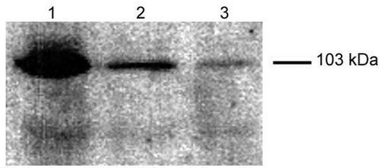 Sample (30ug of whole cell lysate). A: A431. 7.5% SDS PAGE. PPP2R5B antibody. TA308613 diluted at 1:1000.