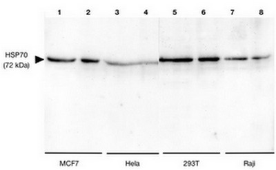 S100A11 antibody detects S100A11 protein by Western blot analysis. A. 30ug A431 whole cell lysate/extract. 15 % SDS-PAGE. S100A11 antibody (TA308680) dilution: 1:1000